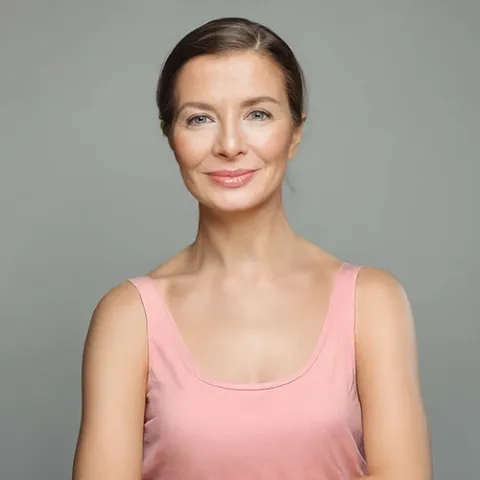 Mujer se realizó blefaroplastia en Salud Colsubsidio